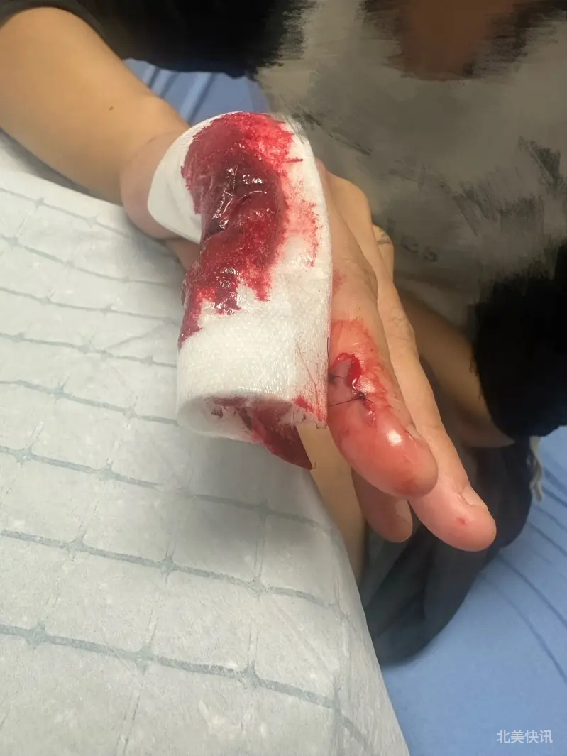 ⚠️洛杉矶华埠惊现机车党抢劫，店主被割伤！大家注意安全！