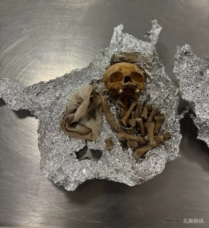 💀佛州机场惊现行李藏人类头骨！CBP紧急销毁⚠️