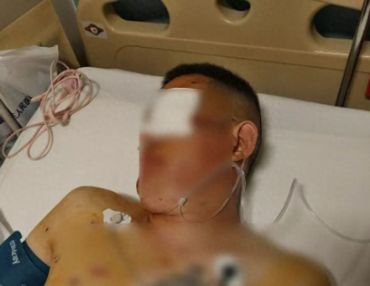 取170万后遭持枪抢劫致左眼失明 男子索赔80万引争议