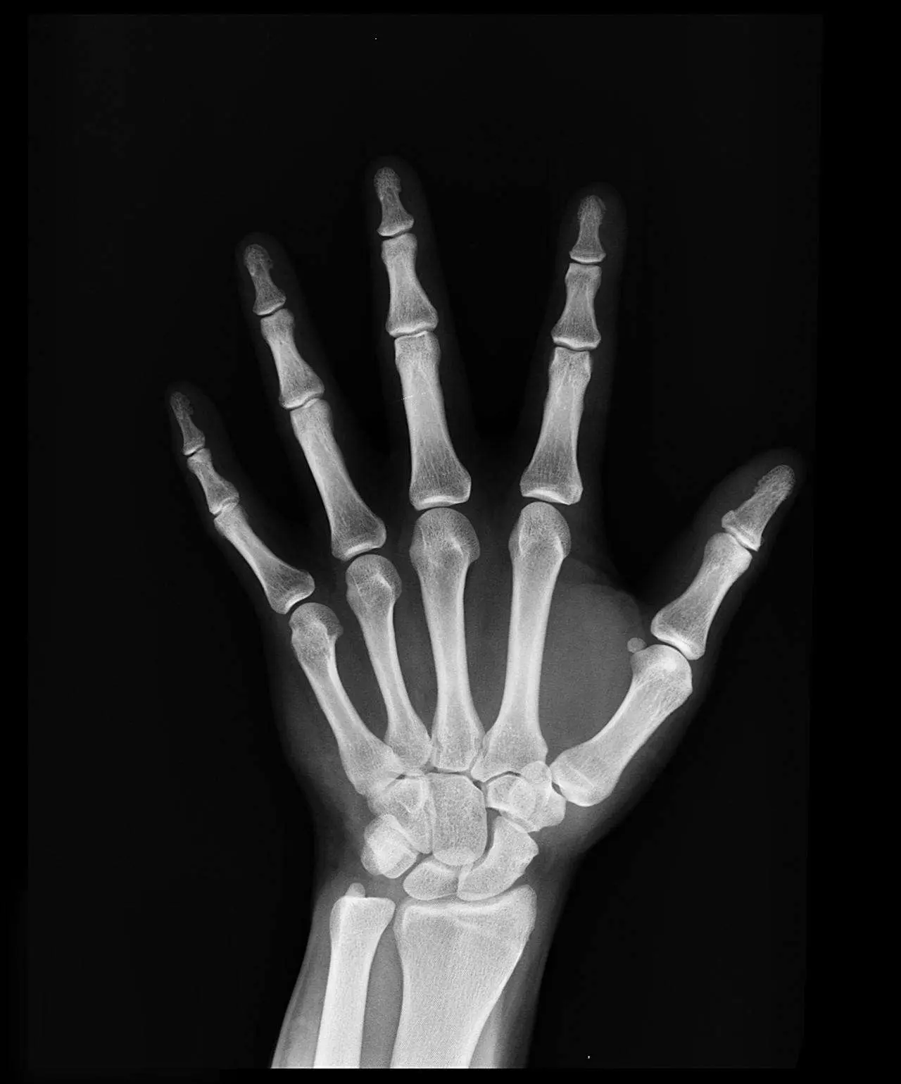 水滴英语小短文，用阅读记住10000单词（人体骨骼主题 metacarpals 掌骨，高效记单词）